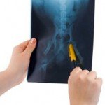 Pet World Insider – Dog Arthritis Cure…